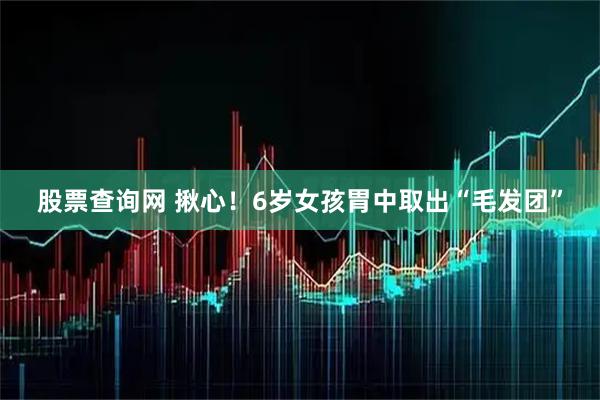 股票查询网 揪心！6岁女孩胃中取出“毛发团”